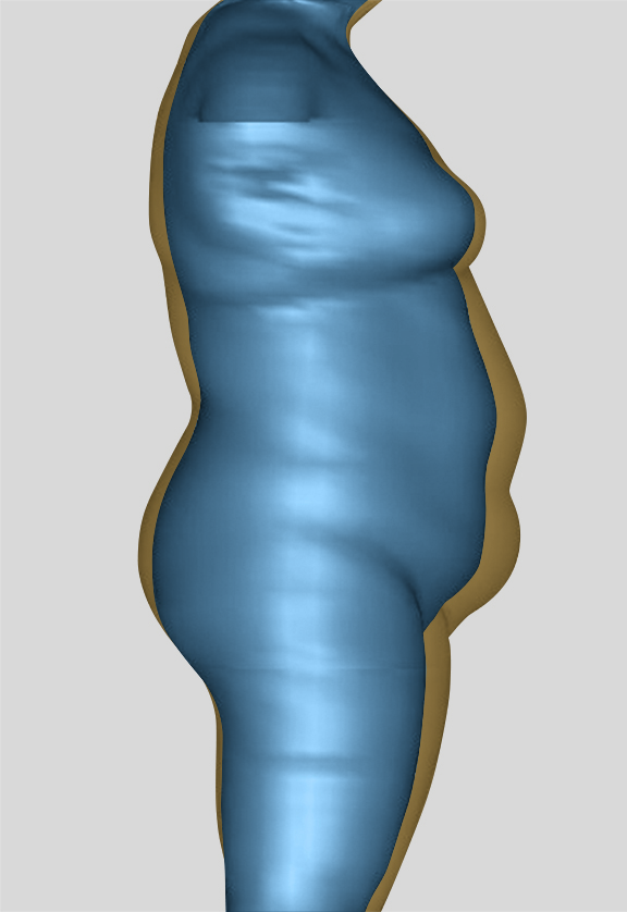 Comparison of body scans showing the later blue surface and the starting gold outline.